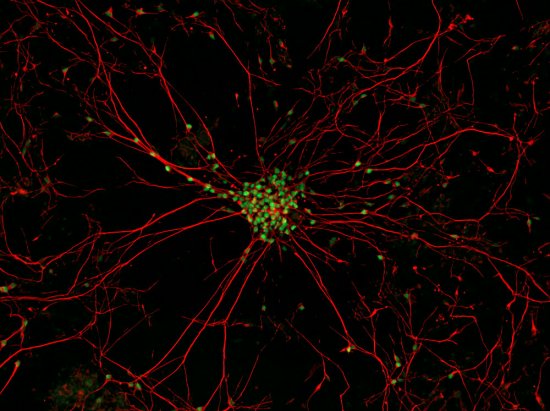 最佳年度生物顯微照片，水蚤微觀照居首